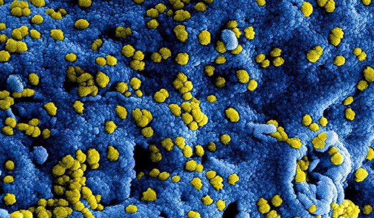 Update 2 coronavirus: "Samen kijken we naar de toekomst"
